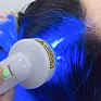Fotobiomodulação