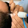 Vacuoterapia
