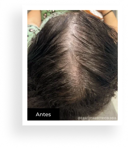 Antes — caso 1
