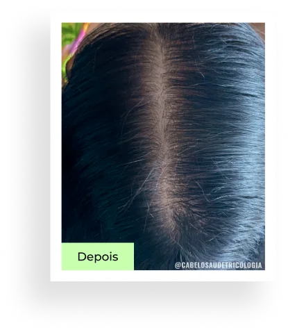 Depois — caso 1