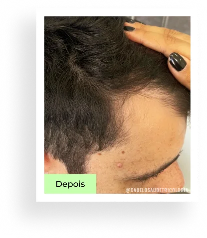 Depois — caso 4